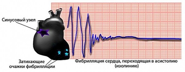 Какой ток опаснее постоянный или переменный: выясняем какой ток является опасным для жизни человека Какой ток опаснее постоянный или переменный: выясняем какой ток является опасным для жизни человека